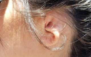 Перхоть в ушах — лечение, симптомы, причины