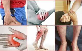 Почему одновременно немеет правая рука и нога — как лечить онемение?