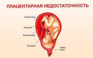 Что означает нарушения в системе мать плацента плод