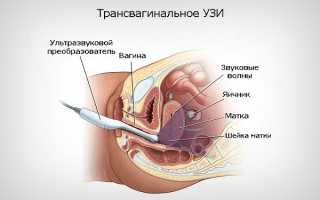 Что видно на УЗИ в 10 недель беременности и стоит ли его делать: норма и отклонения