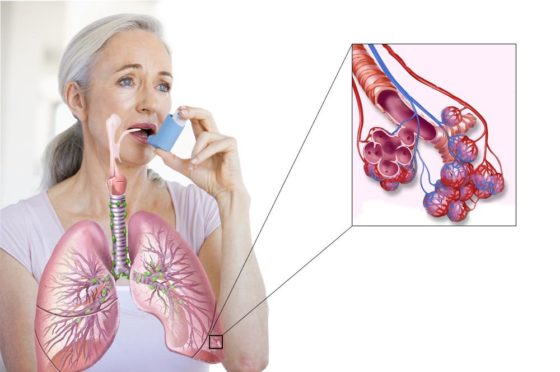 При бронхиальной астме применять Эльбону следует с осторожностью