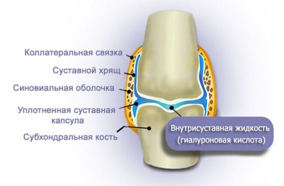 Применение препарата Хаймовис способствует восстановлению объема и свойств синовиальной жидкости