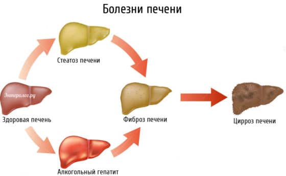 При тяжелых заболеваниях печени применение Випросала запрещено