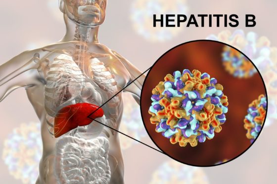 Гепатит В является абсолютным противопоказанием к лечению Ремикейдом