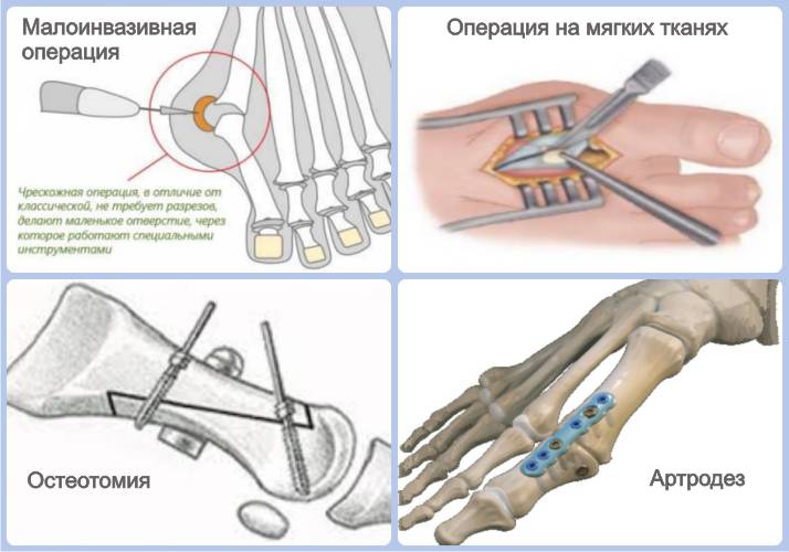 Виды оперативного вмешательства