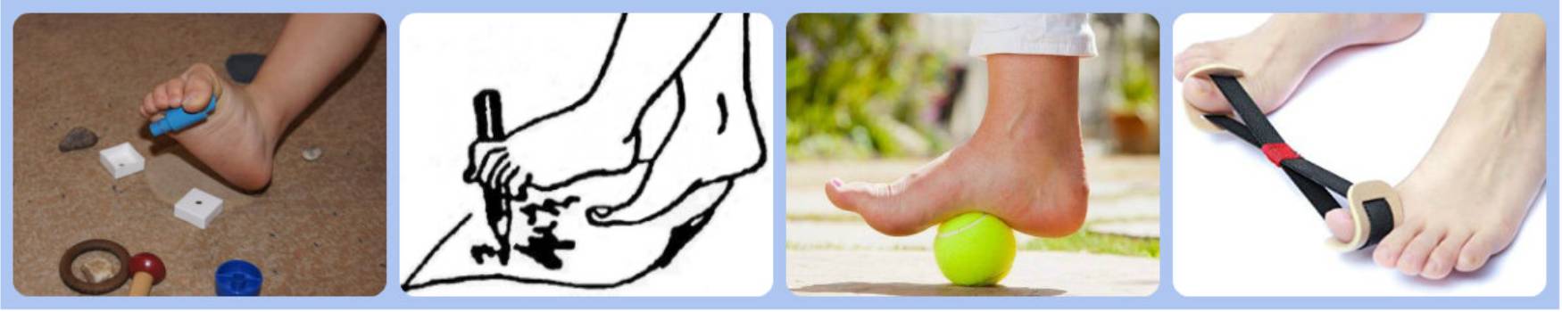 Упражнения при вальгусной деформации большого пальца стопы