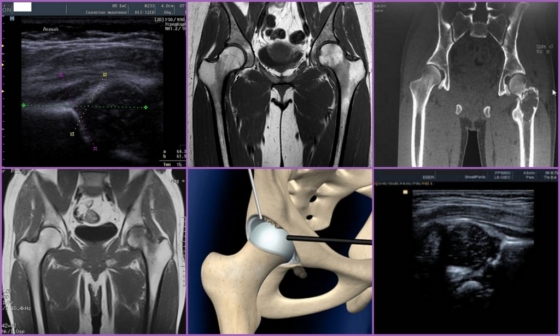 Альтернативные методы обследования тазобедренного сустава