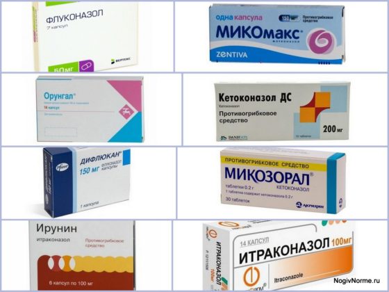 Противогрибковые таблетки из азоловой группы