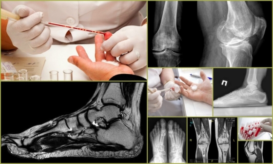 Диагностические методики для определения патологии суставов