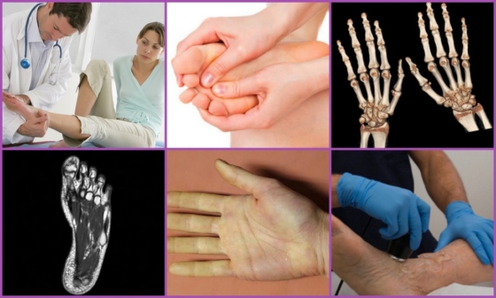Диагностика онемения пальцев рук и ног