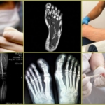 Диагностика причин судорог пальцев