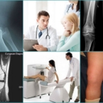 Диагностика тендиноза коленного сустава