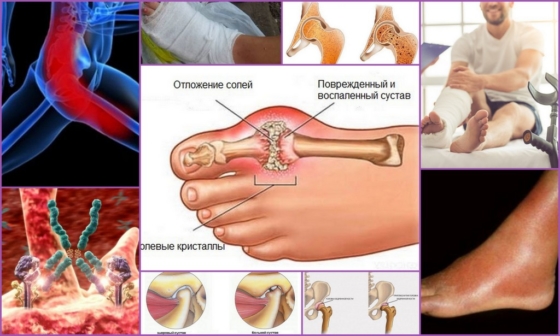 Факторы, способствующие развитию боли