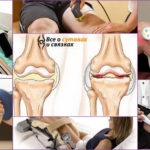 Физиопроцедуры при артрозе колена - выполнение