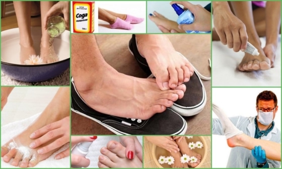 Методы устранения неприятного запаха ног