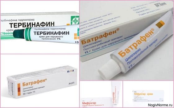 Мифунгар, Батрафен и Тербинафин при лечении грибковых заболеваний
