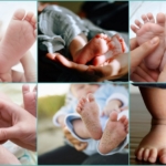Неприятный запах ног у детей разного возраста