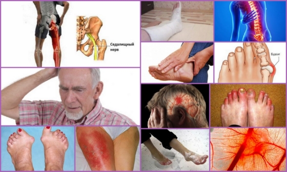 Патологические причины онемения рук и ног