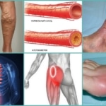 Патологические причины онемения кожи ног
