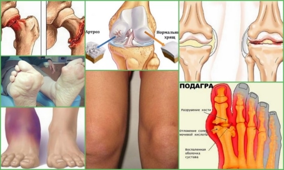 Показания для введения инъекций