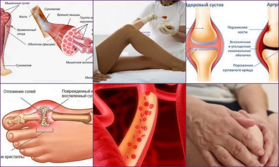 Польза массажа при ревматоидном артрите