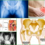 Причины болей в тазобедренном суставе