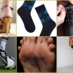 Причины запаха ног в обуви и гипергидроза