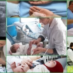 Проведение процедуры УЗИ у новорожденных