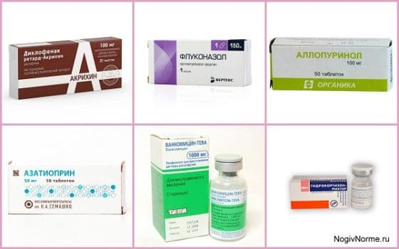 Препараты различных групп, применяемые при лечении артритов