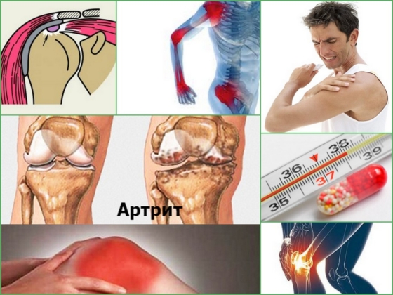 Симптоматика инфекционного артрита