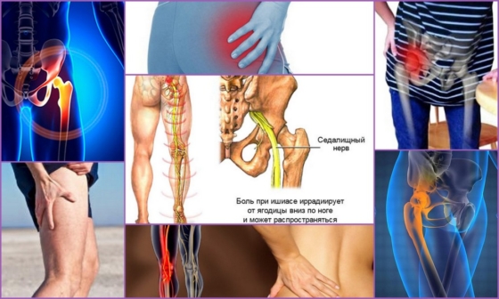 Симптомы болей в тазобедренном суставе
