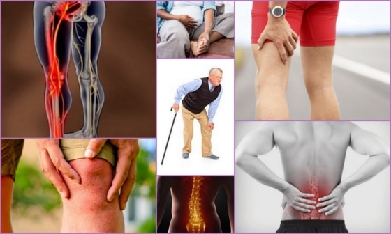 Симптомы онемения левой ноги при поражении ЦНС