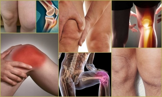 Симптомы при остеохондропатии колена