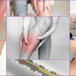 Симптомы развития тромбоза на ногах