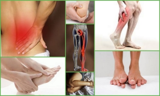 Симптомы возникновения онемения ног