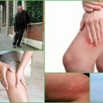 Сопутствующая симптоматика сведения ног судорогой
