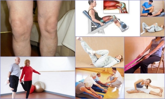 Упражнения для колена при артрозе