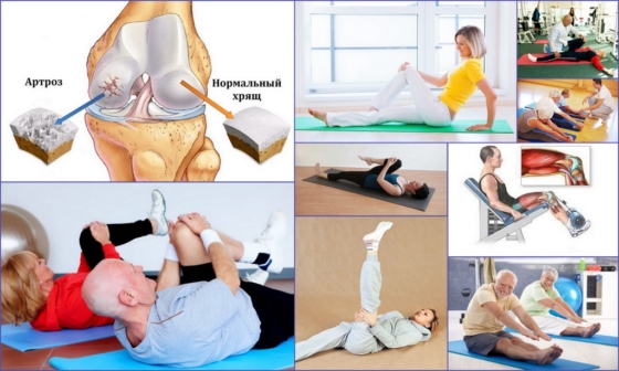 Упражнения при артрозе колена - выполнение