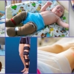 Все методы лечения остеомиелита ног