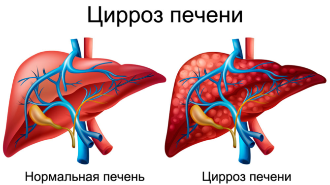 Желтый налет на языке у взрослых фото