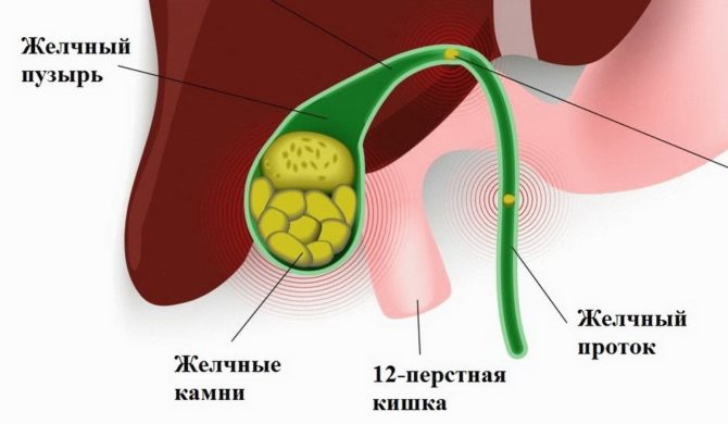 Желтый налет на языке у взрослых фото