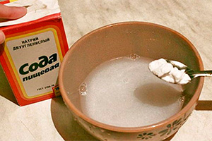 Лечение псориаза содой