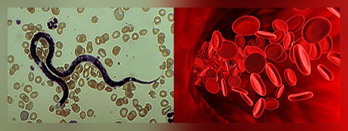 Филярии в общем кровотоке