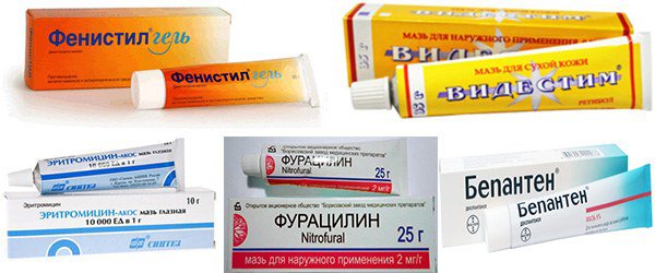 мази от аллергии