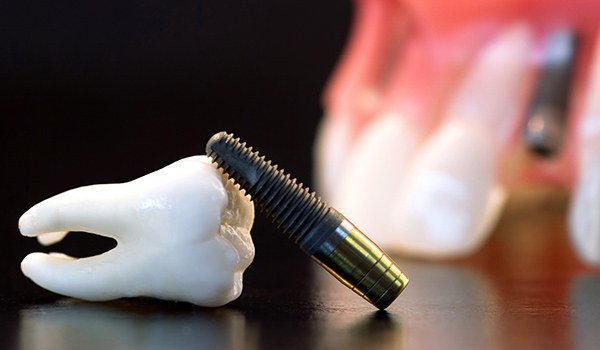 токсикодермия в результате отторжения зубных протезов