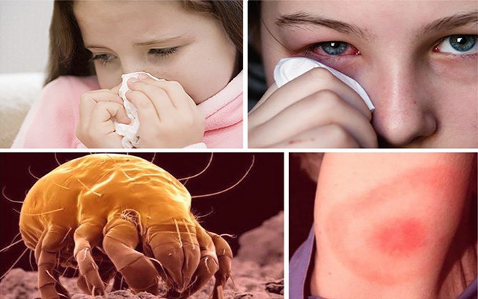 аллергия на постельного пылевого клеща