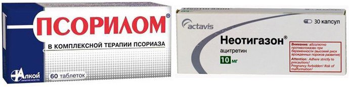 Псорилом, Неотигазон
